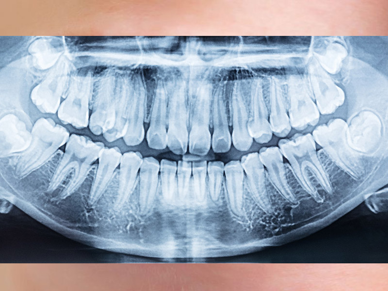 Rehabilitación Oral